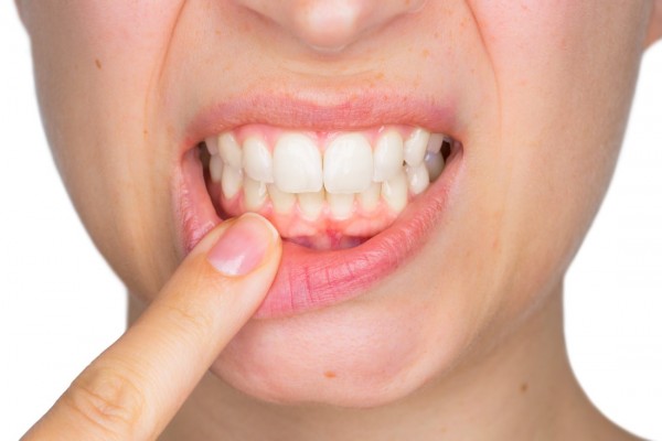 خطرات عفونت و آبسه دندان