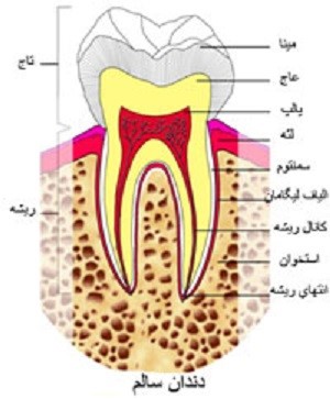 کشیدن دندان