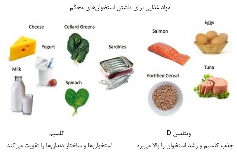 روشهای خانگی پیشگیری از تحلیل استخوان فک