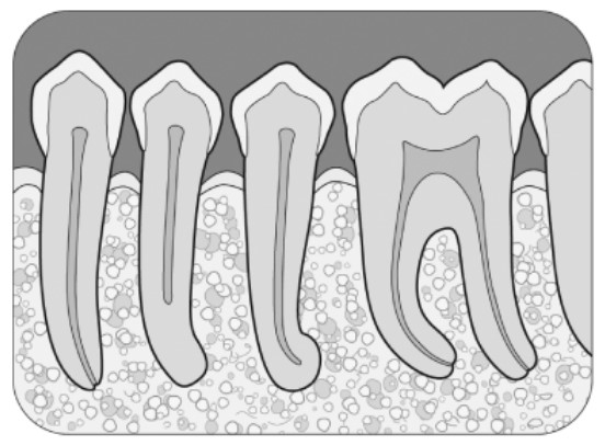 تعداد ریشه و کانال دندان ها
