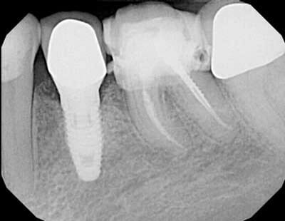 عکسبرداری و رادیوگرافی در دندانپزشکی